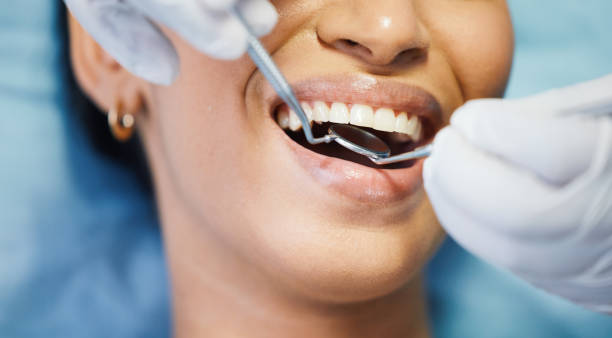Best Emergency Dental Care for Broken or Chipped Teeth in Sutherland, NE