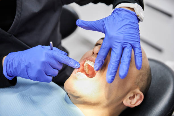 Best Emergency Treatment for Dental Infections or Abscesses in Sutherland, NE